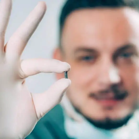 Vergleich der Kosten für Zahnimplantate: Türkei im Vergleich zu Europa und den Vereinigten Staaten