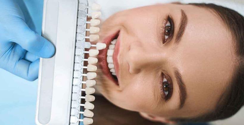 What are dental veneers teeth made of?