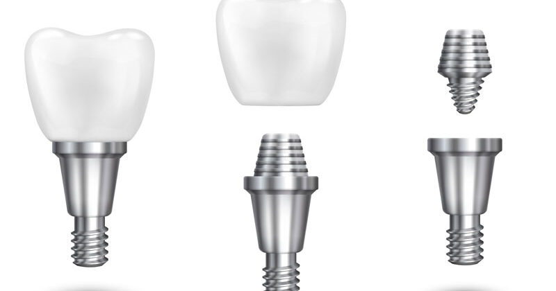 Transform Your Smile with Dental Implants in Marmaris, Turkey