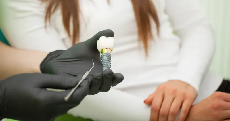 Mini Dental Implants vs Traditional Implants: What’s the Difference?